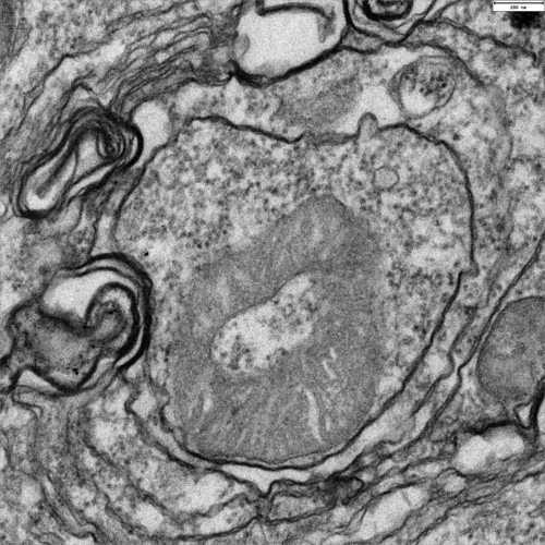 Mitocondria dentro de un autofagosoma durante el proceso de mitofagia. Foto: CSIC.