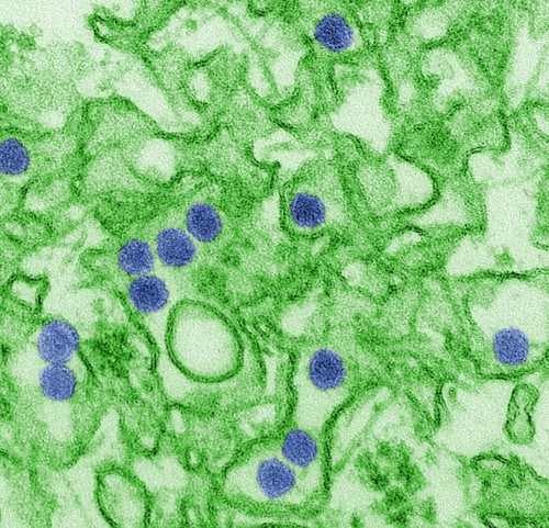 Micrografía electrónica del virus del Zika, en azul/ Wikimedia Commons.