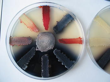 Diferentes muestras de Streptomyces con distintos niveles de producción de antibióticos (Foto: R. Santamaría-IBFG).