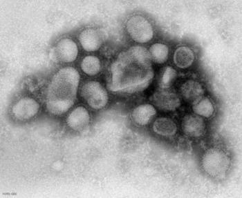 Virus de la gripe A/H1N1
