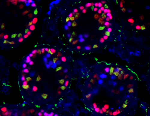  Las células rojas aún son testiculares, y las verdes ya se han transformado en células ováricas. Imagen: UGR.