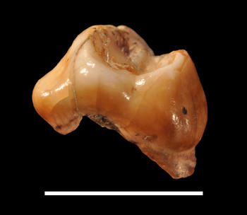 Vista mesial del specimen Cavallo-B (primer molar maxilar izquierdo decidual), el primer humano anatómicamente moderno de Europa. / Stefano Benazzi.