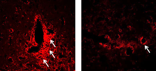 Microglía (en rojo) que provoca daños. En ambiente enriquecido (derecha), se reduce.