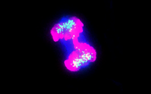 Defective chromosome separation in a cell derived from a patient with biallelic mutations in the BUB1 gene. Mitotic chromosomes, magenta; centromeres, green; spindle, blue © Sara Carvalhal, 2022