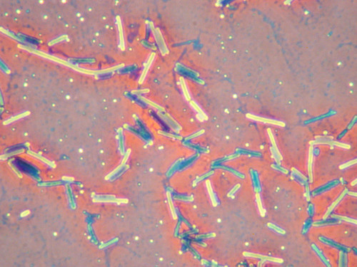 Microorganismos del género Clostridium/Mauricio Bernal