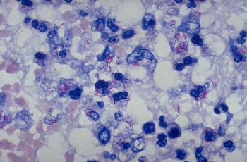 Bacteria causante de la Tuberculosis (Foto: MEC)
