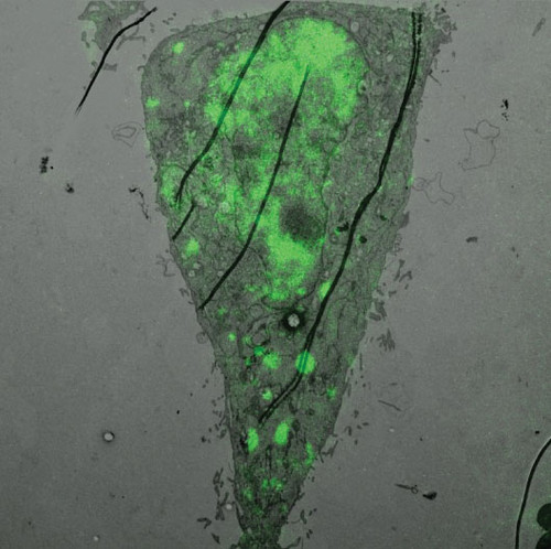 Electron microscopy image overlapped with fluorescent microscopy image of an epithelial cell infected with influenza virus. Viral inclusions where the influenza genome assembles are located in green. 