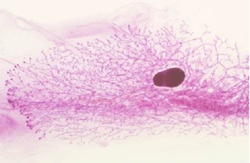 La pérdida de Sfrp3 estromal afecta la ramificación, la estructura ductal y la diferenciación del epitelio de la mama, lo que aumenta la predisposición al desarrollo de tumores en este tejido./ CBMSO