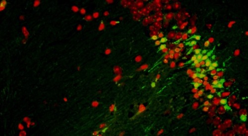 Imagen microscópica de neuronas./ CSIC.