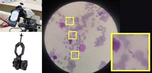 El algoritmo puede identificar al protozoo 'Trypanosoma cruzi' en fotos de muestras de sangre obtenidas con cámaras de teléfonos móviles.