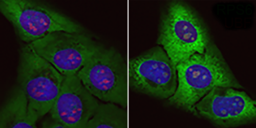 Células normales (izquierda) y células sometidas al efecto de la proteína tóxica (derecha)./CNIO.