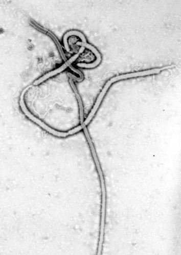 Virus del ébola.
