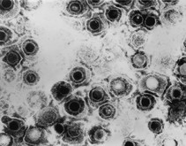 Virus del herpes. Wikimedia Commons.