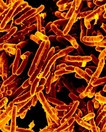 MicrografÃ­a electrÃ³nica de barrido con color artificial de Mycobacterium tuberculosis, agente causal de la tuberculosis CrÃ©dito NIAID