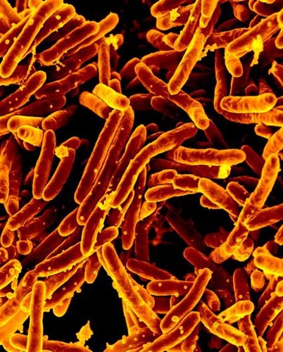 Micrografía electrónica de barrido con color artificial de Mycobacterium tuberculosis, agente causal de la tuberculosis Crédito NIAID
