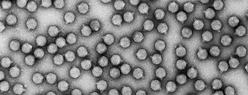 Virus bacteriófago T7.