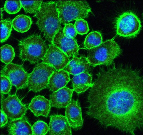 Una célula SCC25 estimulada con los metabolitos de la biopelícula de C.albicans vista mediante microscopía confocal/FOAr-Unesp