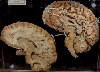 Sección del cerebro.
