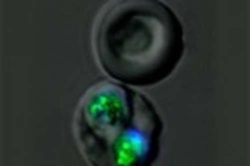Dos eritrocitos vivos, el inferior infectado por 'Plasmodium falciparum'. FOTO: E. L. BASTOS