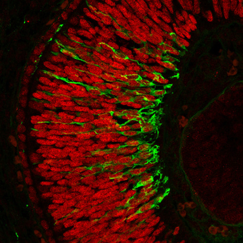 Expresión de Meis1 (en rojo) en la retina de un embrión silvestre y también teñida con un marcador de neuronas (en verde).