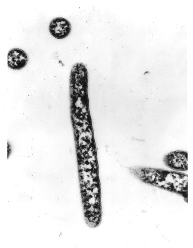 Micrografía electrónica de células de la bacteria de la Antártida Bizionia argentinensis.  Créditos: Doctor Walter Mac Cormack, Instituto Antártico Argentino.