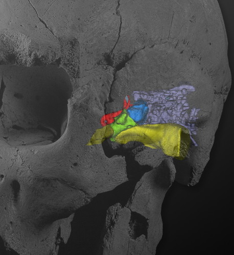 Montaje del Cráneo 5 de la Sima de los Huesos (