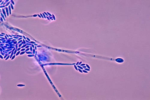 Hongo del género Fusarium, uno de los patógenos de plantas que se investigará en el Proyecto SUPERA.