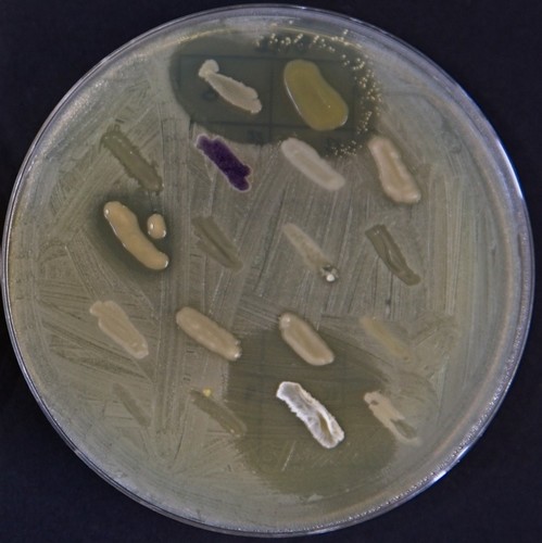Placa con microorganismos productores de antibióticos seleccionados./ IBFG.