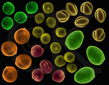 Granos de polen de distintas especies vistos al microscopio (Foto: ACLAIC)