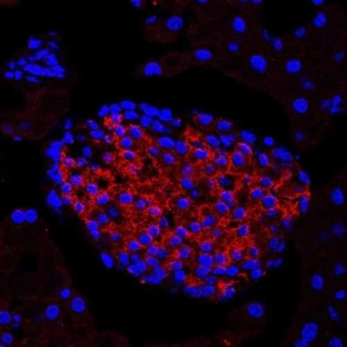 Células beta pancreáticas, en las cuales la insulina aparece marcada en rojo FOTO: ESTELA GIL Y AMARYLIS WANSCHEL