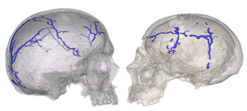 Método computarizado para reconstruir digitalmente el sistema vascular interno de los huesos del cráneo. FOTO: CENIEH