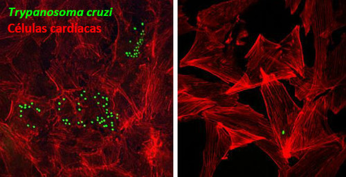 Efecto de carvedilol in vitro: Imágenes de microscopía de fluorescencia de células cardíacas (en rojo) infectadas con Trypanosoma cruzi (en verde) en condiciones control (foto de la izquierda) o tratadas con carvedilol (foto de la derecha). 