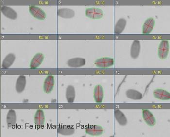 Sistema de análisis para estudiar el tamaño de la cabeza de espermatozoides de carnero. A la izquierda de cada imagen está la cabeza, a la derecha, el reconocimiento de ejes y perímetro.