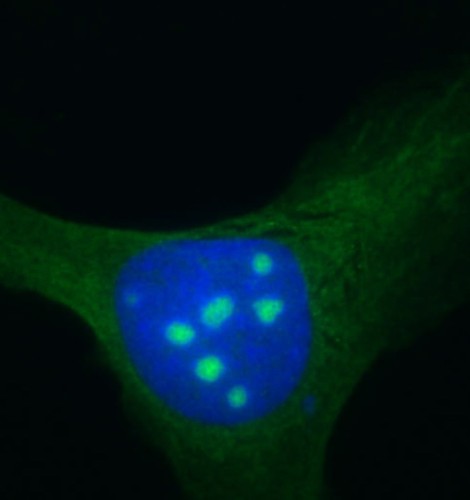 Localización del factor de síntesis de ribosomas Rrp12 en los nucleolos de una célula de osteosarcoma humano. Foto: Mercedes Dosil.