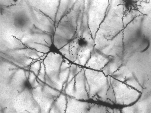 Neurona humana. FOTO: Wikimedia Commmons/ MethoxyRoxy