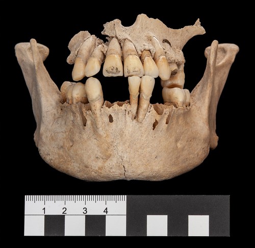 Dentadura de uno de los individuos de la fosa común de Uxul © Photo: Nicolaus Seefeld 
