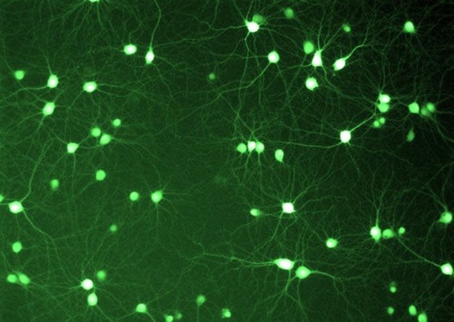 Neuronas de hipocampo de rata aisladas y cultivadas en placas de Petri. Las mismas expresan la proteína fluorescente verde (GFP). / CONICET.