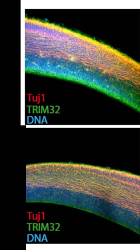 El cerebro de ratones carentes de p73 (p73KO) presenta menor expresión de TRIM32 (verde) y menor número de neuronas (rojo)  en la región subventricular (SVZ). FOTO: Carmen Marín.
