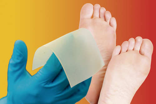 Desarrollan un sustituto de piel de origen polimérico para curar el pie diabético.