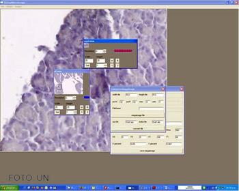 Software informático para el procesesamiento de imágenes de microscopio.