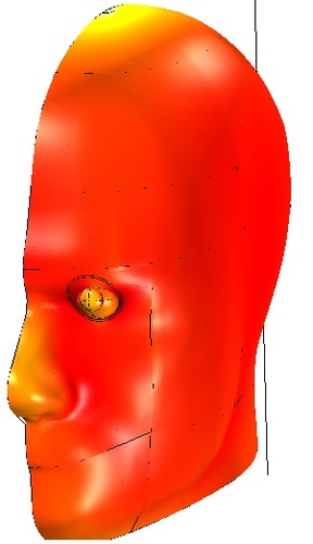 Geometría que representa la distribución del índice de absorción especifico (SAR) en una persona implantada con la microválvula, expuesta a un campo electromagnético de 8,5MHz. Imagen: UNL.