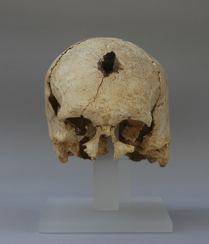 Uno de los individuos estudiados, que aparece con el cráneo perforado. Foto: Archivo Museu d'Arqueologia de Catalunya.