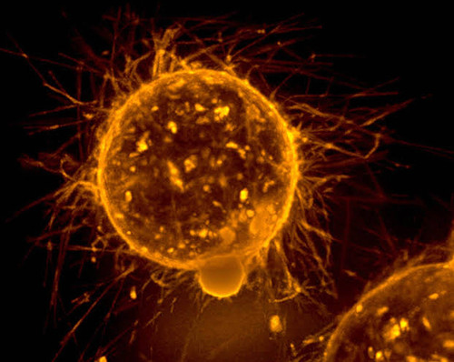 Las células troncales cancerosas pueden ser clave para detener la metástasis.