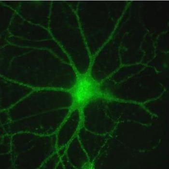 Imagen de una neurona.
