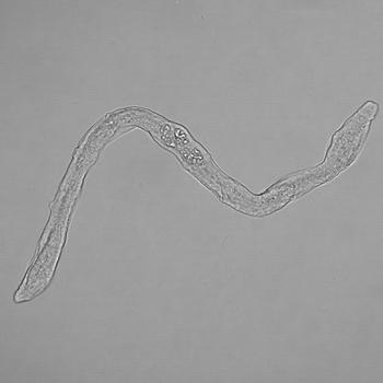 Esquistosómula, un gusano inmaduro de 'Schistosoma bovis' durante su migración por el organismo del hospedador definitivo. Imagen: Eduardo de la Torre.