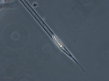Ejemplar de diatomea 'Rhizosolenia'.