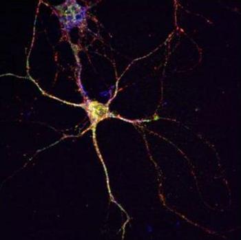 Imagen del Instituto de Neurociencias de Castilla y León en la que se observa una neurona