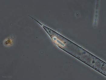 Ejemplar de diatomea 'Rhizosolenia'.