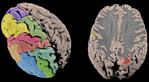 Imagen de la superficie cortical y el grosor. Imagen: CIBER.