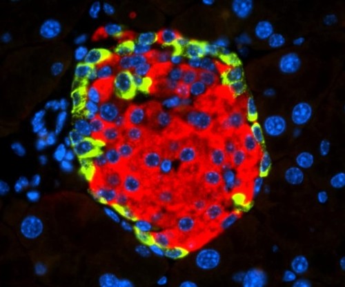 Islotes de Langerhans con insulina secretada por las células beta (en rojo) y glucagón secretado por las células alfa (en verde).